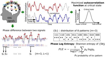 Delirium, Caffeine, and Perioperative Cortical Dynamics